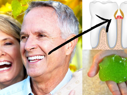 Dentitox_white-teeth-design-2-